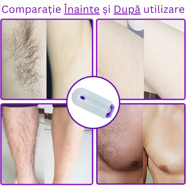 Epilator Fără Durere, Portabil, Rezistent la Apă