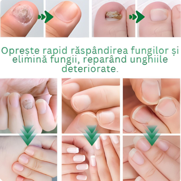 Serul pentru unghii sănătoase