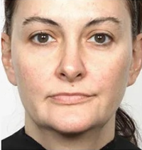 După